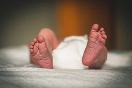 18 day old infant survives emergency surgery for life threatening intestinal twist at tripura medical college
