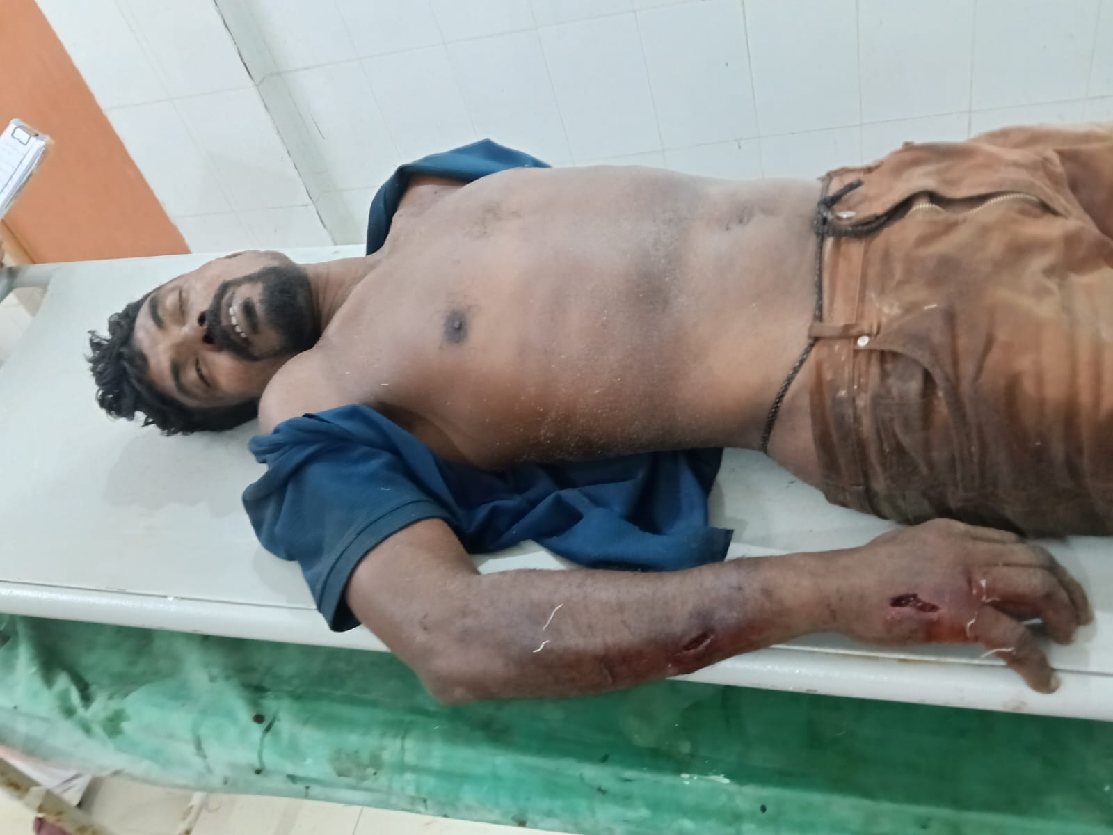 Suspected cow thief beaten to death in Kalyanpur